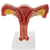 Sistema Reproductor Femenino Corte Kits